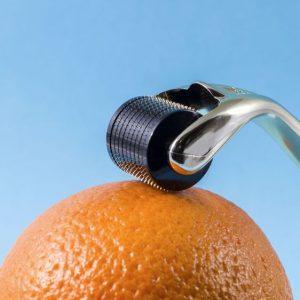 Microneedling vs DermaRoller