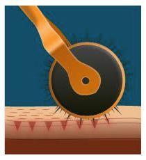 Microneedling vs DermaRoller