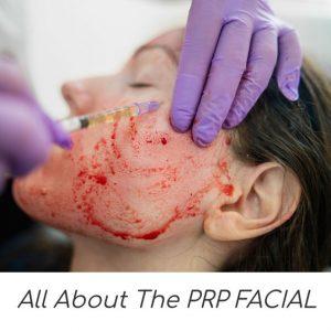 Vampire Facial